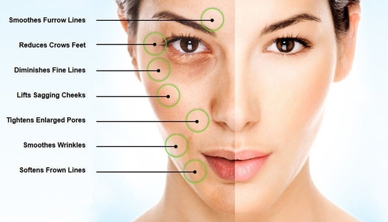 Hyaluronsäure-Pulver EINECS 232-678-0 2000 - 5000 Dalton Pure Hyaluronic Acid Serum Pulver